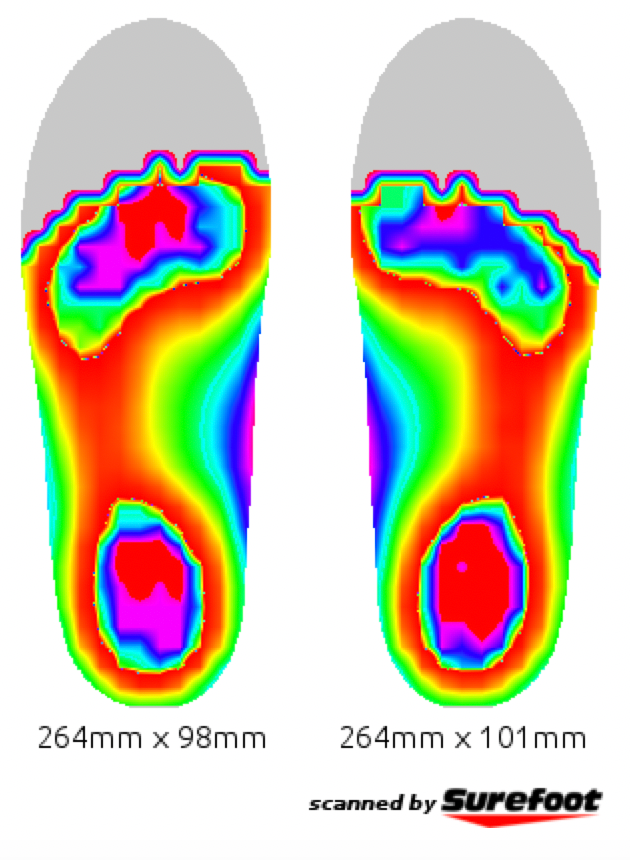 Surefoot insole scan None