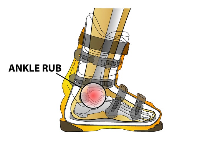 Inside Ankle Rub Problem: Inside ankle rub caused by feed pronating (collapsing inwards) and ankles pressing against the shell.Solution: Custom footbeds to support…